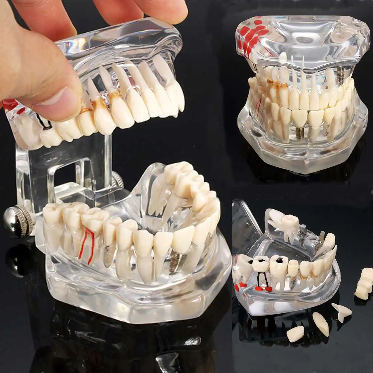 Искусственные зубы