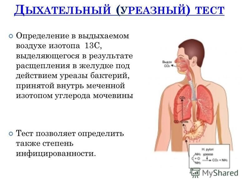Дыхательный тест клиника. Дыхательный тест. Уреазный дыхательный тест. 13с-уреазный дыхательный.
