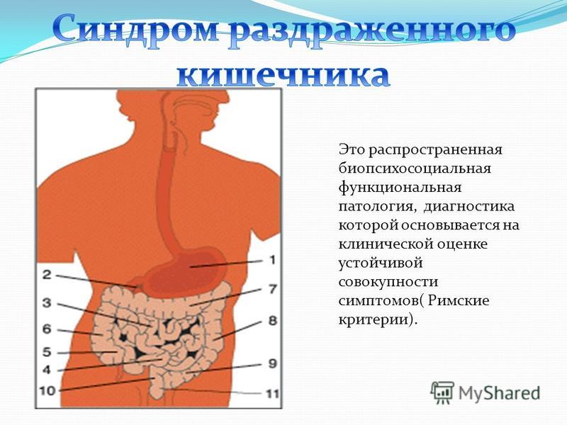 Проблемы с кишечником симптомы у женщин. Раздражение ЖКТ симптомы. Симптомы СРК кишечника у мужчин. Проблемы с кишечником симптомы.