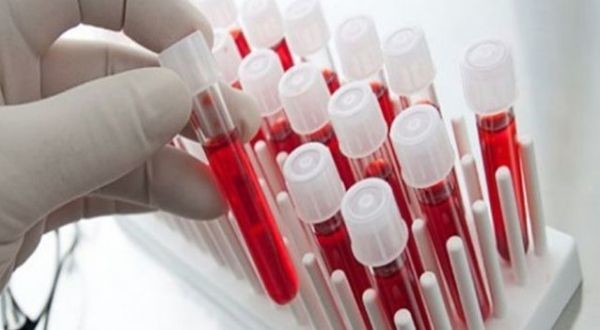 Онкомаркер СА 125: норма и расшифровка результатов анализа крови