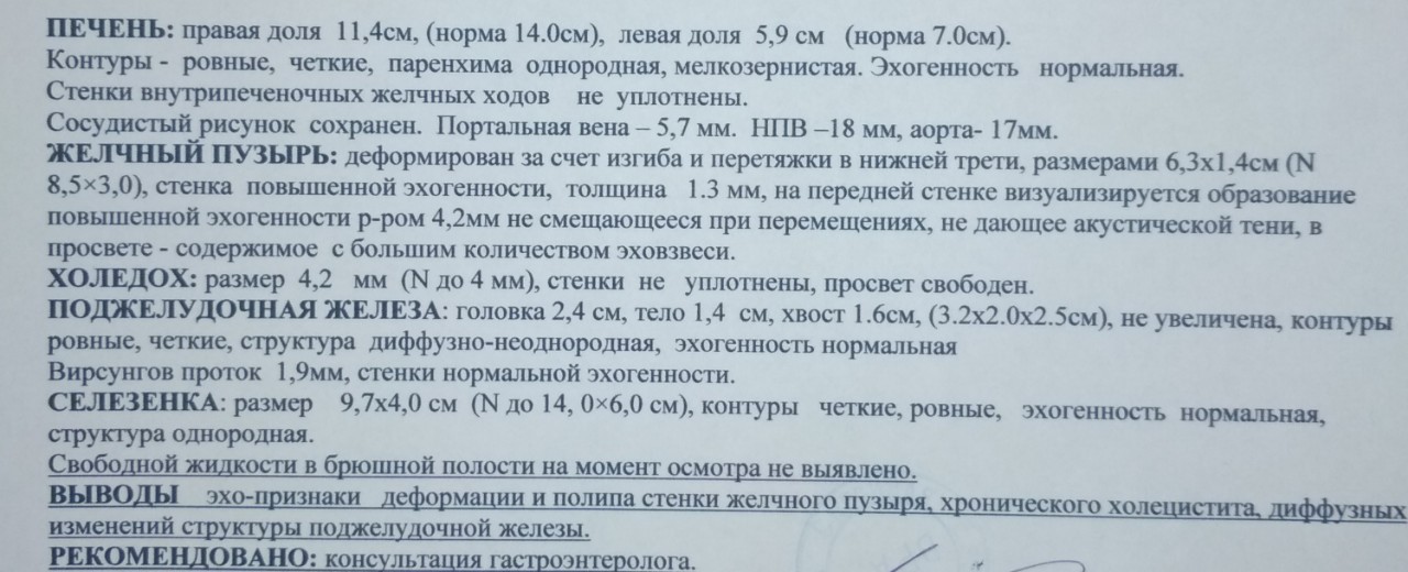 Полип желчного пузыря мкб 10