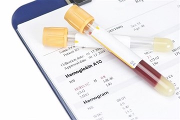 Гликированный гемоглобин: что показывает анализ, что такое HbA1c