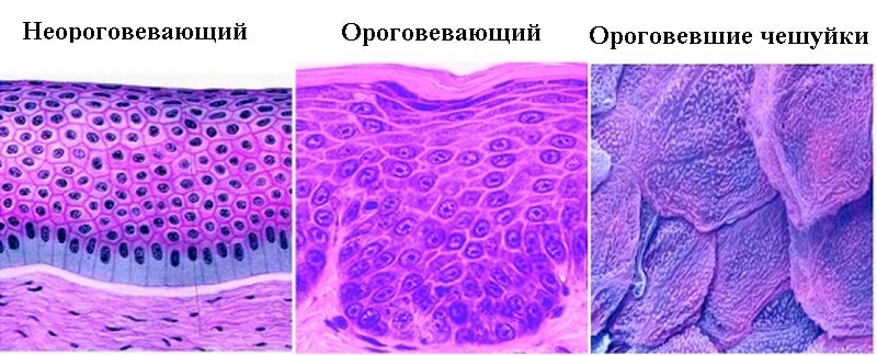 Эпителий кожи. Многослойный ороговевший эпителий. Многослойный плоский ороговевающий эпителий. Многослойный плоский эпителий под микроскопом. Многосл ороговеваюший эпмтелий.