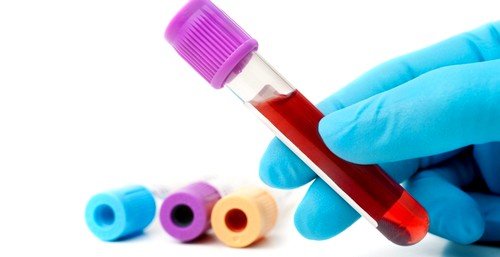 При анализе крови повышается уровень эозинофилов, а показатель лейкоцитов снижается