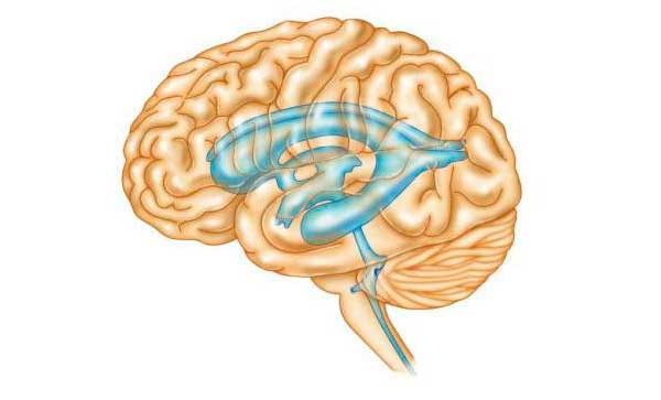 Смешанная гидроцефалия головного мозга