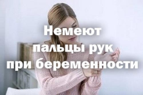 Немеет беременности. Немеют пальцы при беременности. Немеют руки при беременности. Онемение пальцев рук при беременности. Немеют пальцы на руках при беременности.