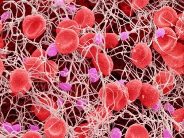 Насколько опасно повышение тромбоцитов в организме человека?