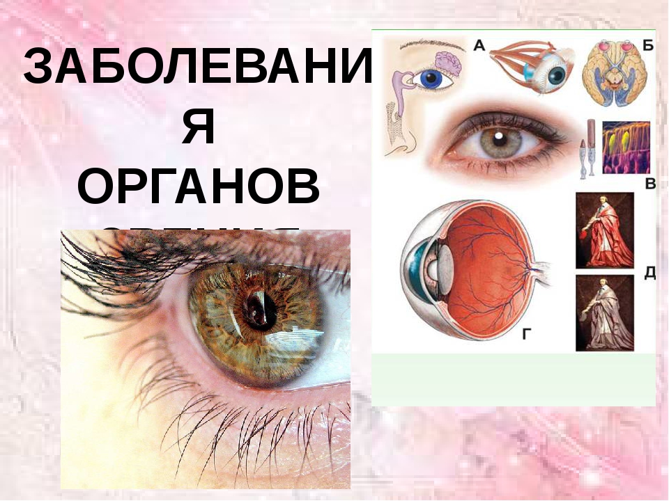 Заболевания глаз биология 8 класс. Заболевания органов зрения. Презентация болезни глаз. Патологии органов зрения. Поражение органов зрения.