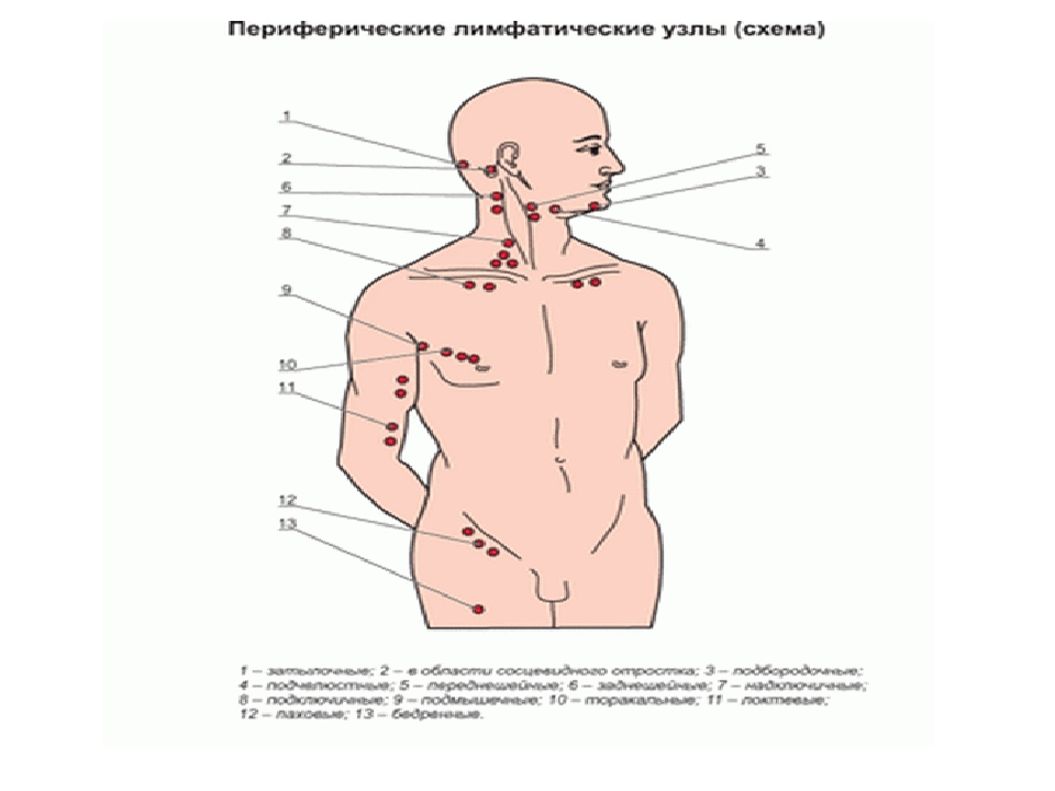 Как узнать лимфоузел. Лимфоузлы на грудной клетке у мужчин схема. Торакальные лимфоузлы расположение. Паховые лимфатические узлы схема.