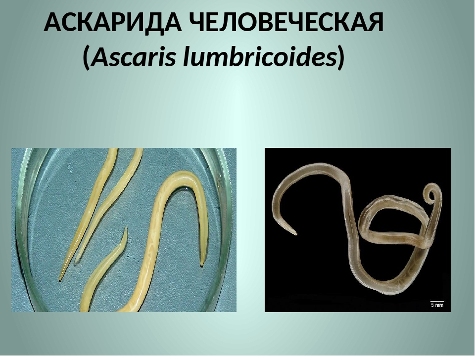 Человеческая аскарида круглый червь. Аскарида человеческая (Ascaris lumbricoides) – возбудитель аскаридоза. Аскарида lumbricoides цикл.
