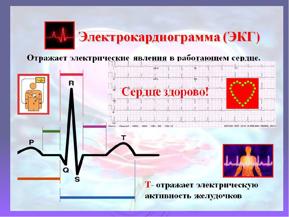 Основы экг презентация