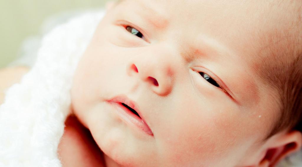 Белые выделения из глаз у новорожденного