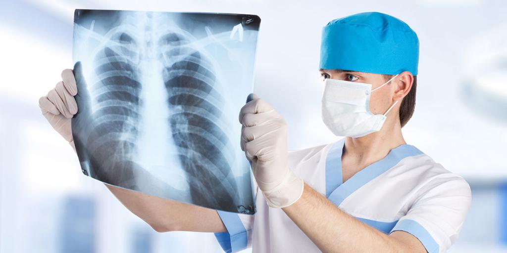 Без рентгенографии тяжело представить своевременное выявление многих заболеваний легких