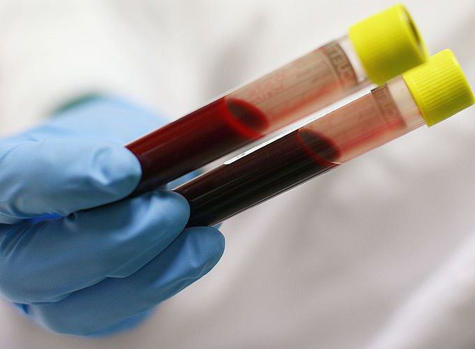 биохимический анализ крови что покажет