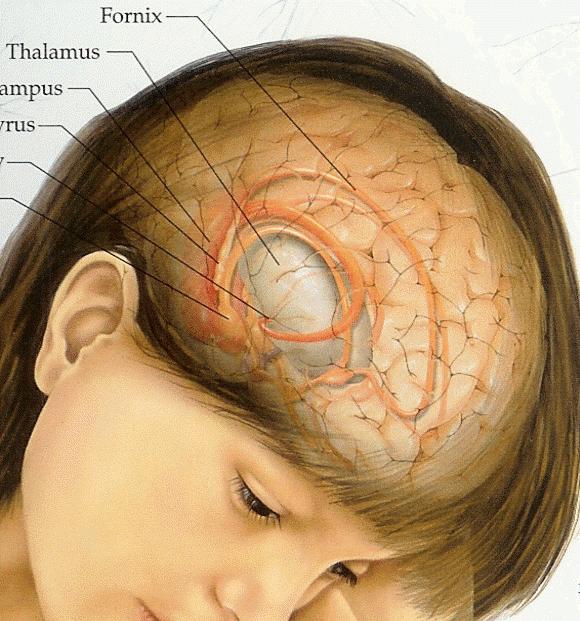 опухоль мозга симптомы на ранней стадии