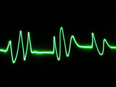 Радиочастотная абляция сердца. Отзывы