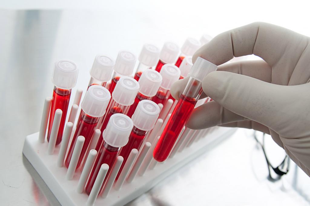 общий анализ крови при онкологии