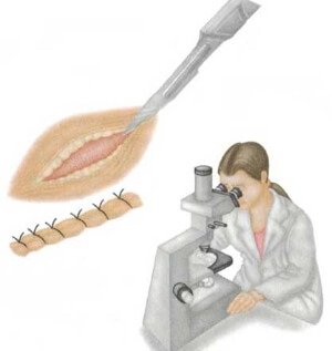 Микроскопия
