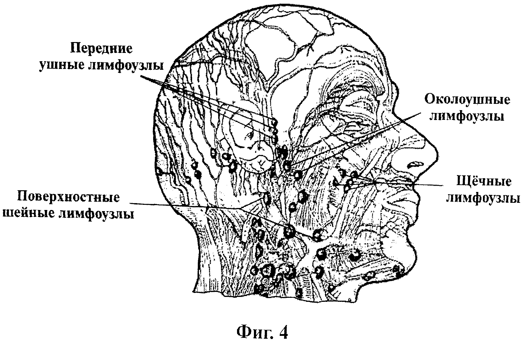 Лимфатическая система лица и шеи схема