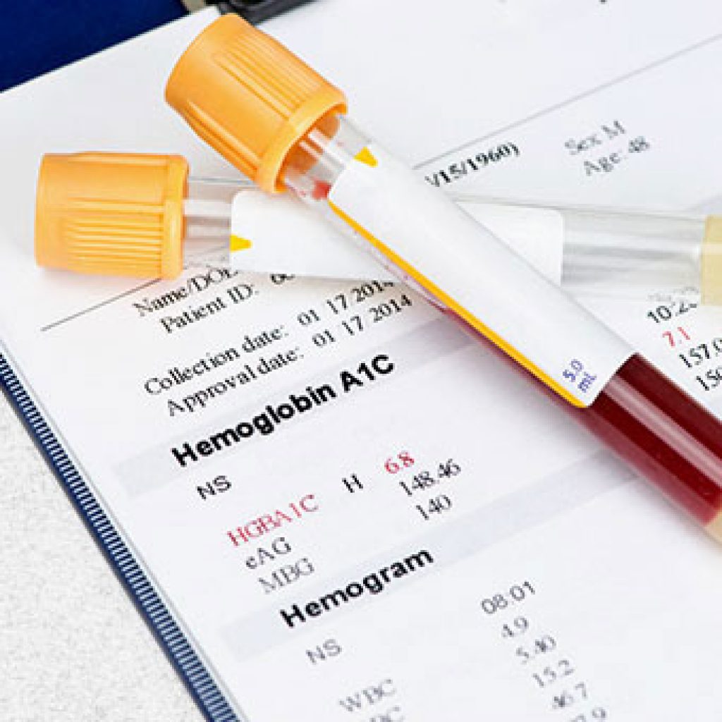 Тест гемоглобина в крови. Гликированный гемоглобин (hba1c). Пробирки для гликированного гемоглобина. Гемоглобин a1c норма. Hba1c (гликированный HB) 4.9.