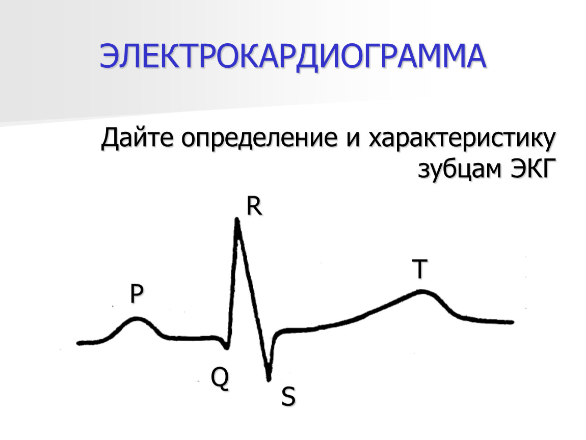 Рисунок экг с подписями