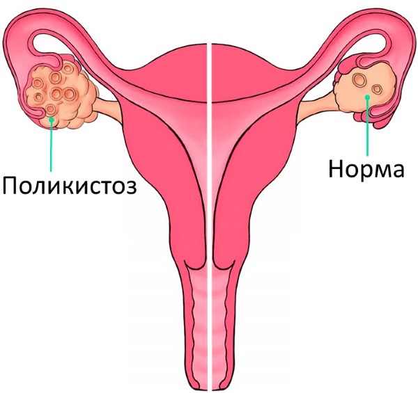 Менструальный цикл: что это, фазы, нарушения, как рассчитать начало, норма, сбой, как восстановить