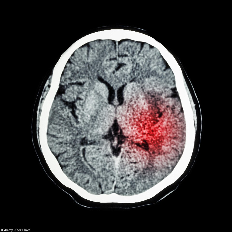 More than 180,000 Britons a year have a heart attack – that’s one person every three minutes. To add to this, more than 100,000 suffer a stroke. Almost 200,000 people a year will die from these two conditions. It is especially tragic given that, according to recent figures, about 80 per cent of these deaths in the under-75s could be prevented (file image)