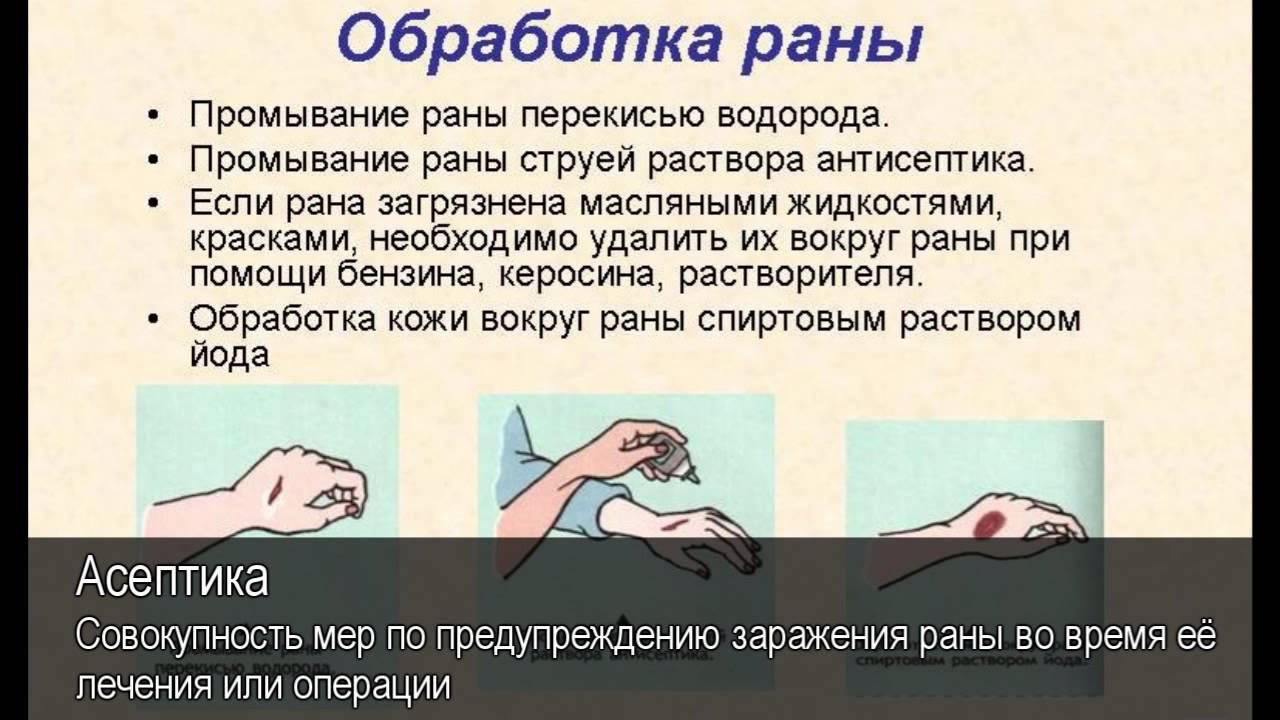 Обработка ран презентация