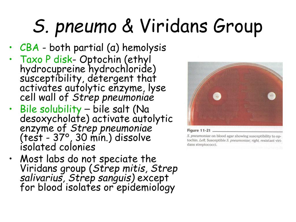 Streptococcus viridans что это. Streptococcus Viridans Group норма. Streptococcus SPP. Группы Viridans. Streptococcus гр. Viridans. Streptococcus Viridans Group 10 5 кое/мл.