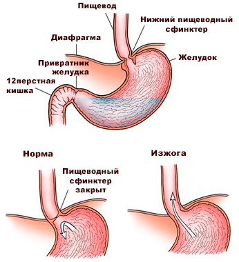 Клапан между желудком и пищеводом. Пилорический сфинктер желудка. Пищеводный сфинктер анатомия. Привратниковый сфинктер желудка. Пилорический сфинктер желудка диаметр.
