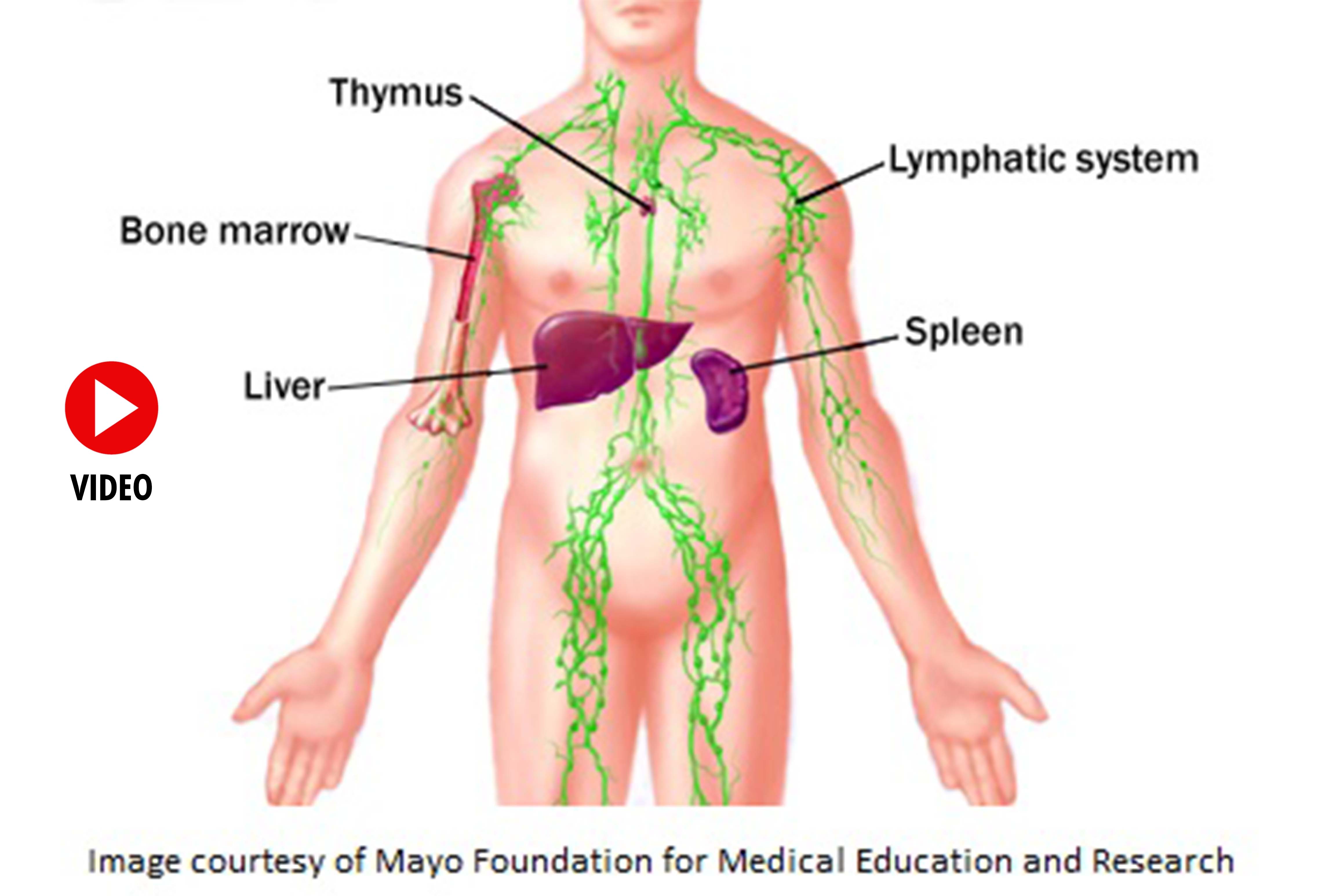 Лимфа повышенная. Подмышечные лимфатические узлы увеличенные расположение. Подмышечные лимфатические узлы воспаление. Расположение лимфатических узлов под мышкой. Воспаленные лимфатические узлы на подмышках.