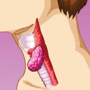 Ком в горле при щитовидной железе симптомы 