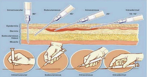 Схема внутримышечного укола