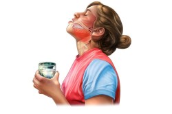 Полоскание при воспалении слизистой горла