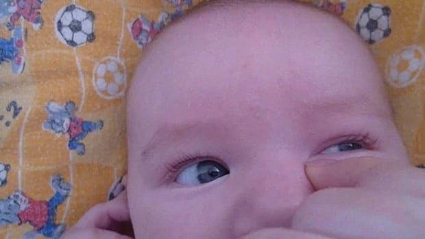 массаж глаз новорожденных