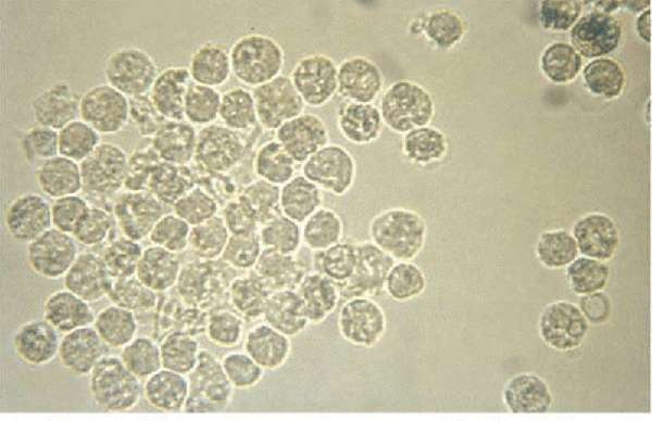 лейкоциты под микроскопом