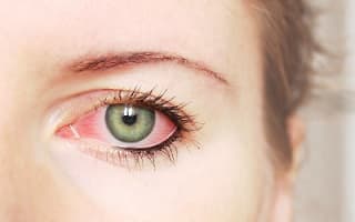 Инфекционные болезни глаз причины