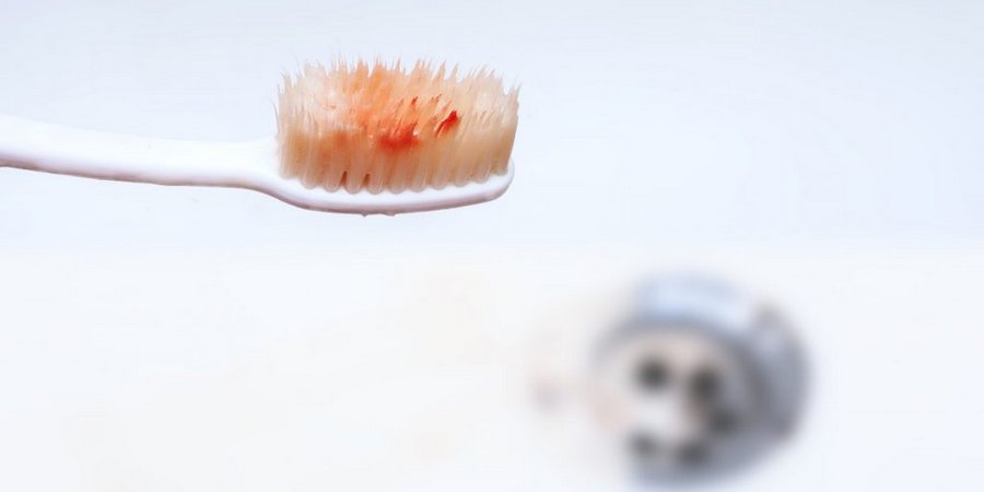 Кровоточивость при чистке зубов