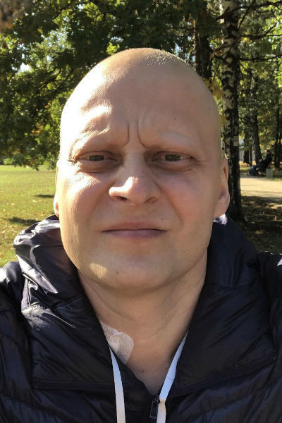 После курса химиотерапии Андрей стал выглядеть так