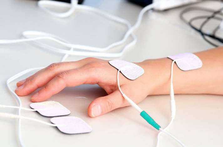 Электростимуляция мышц руки