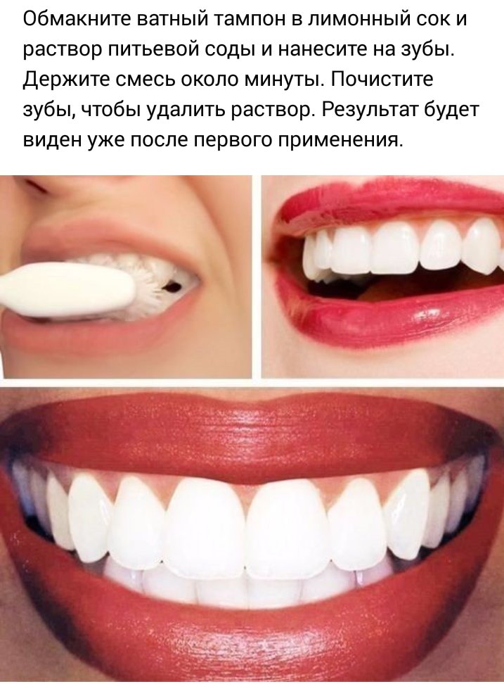 отбеливание зубов колой отзывы