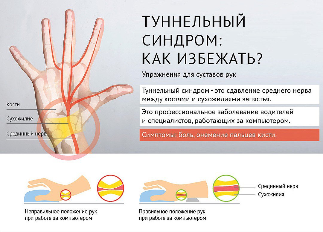 Сильно болят пальцы рук что делать. .Туннельный синдром запястья туннельный. Туннельный синдром лучезапястного сустава. Операция туннельный синдром запястья кисти.
