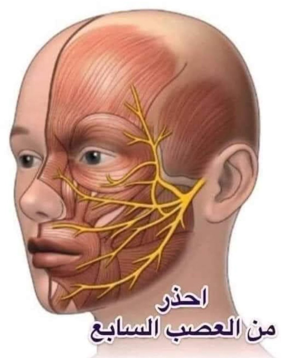неврит лицевого нерва лечение фото