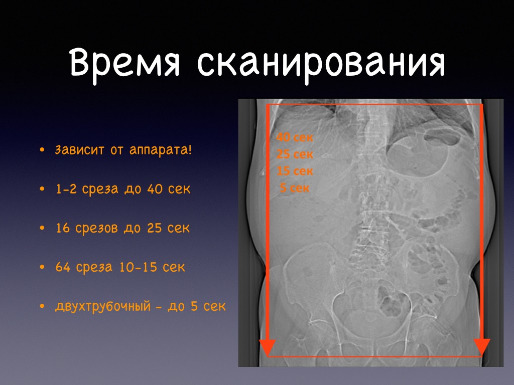 Подготовка брюшной полости. Фазы контрастирования брюшной полости кт. Подготовка к кт брюшной полости с контрастированием. Кт брюшной полости с контрастом подготовка. Контрастирование при кт брюшной полости.