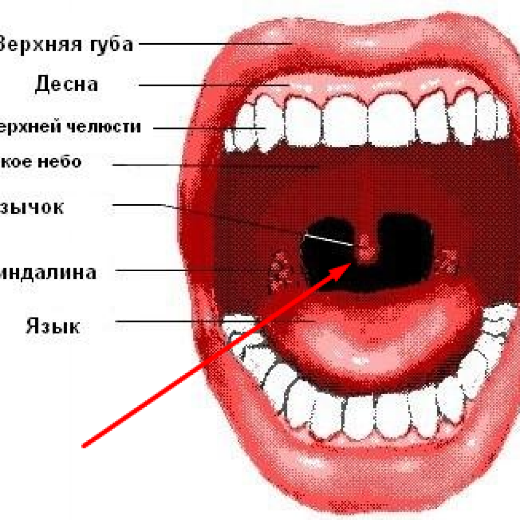 Рот 2. Воспаление небного язычка. Маленький язычок в горле.