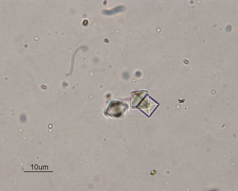 Ураты в моче фото под микроскопом