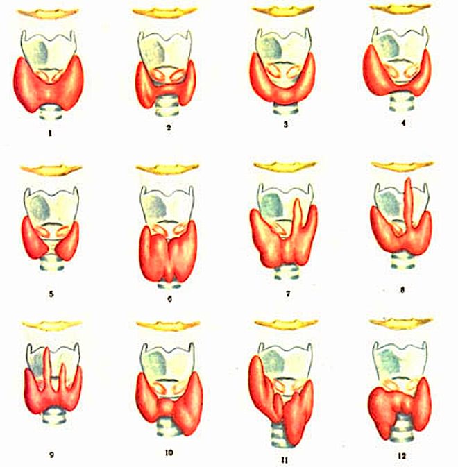 нормальные формы щитовидной железы