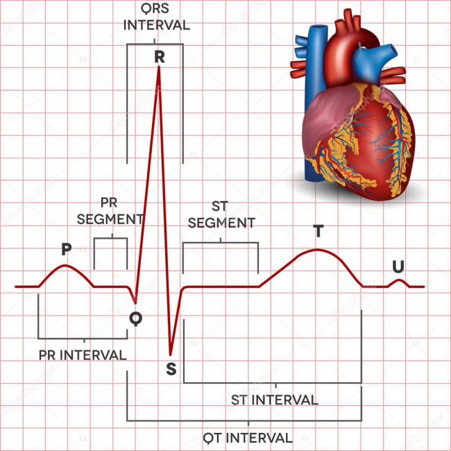 Синусовый ритм вместе с вертикальным положением электрической оси сердца (ЭОС) показывает, что эти параметры находятся в пределах нормы. Вертикальная ось показывает проекцию положения органа в грудной клетке