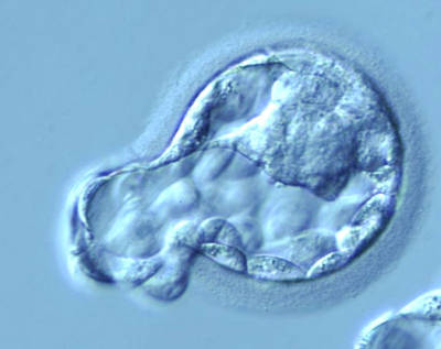 Имплантация эмбрионов при ЭКО