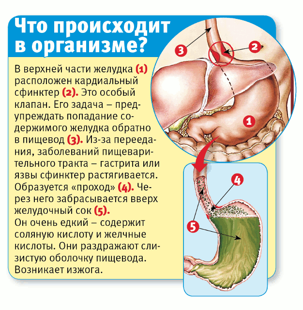 Недостаточности желудка